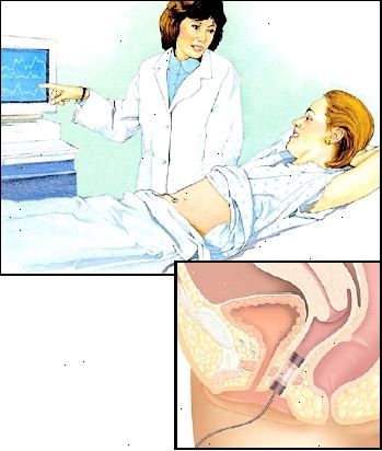 Při biofeedbacku, senzory vysílají signály z vašich svalů pánevního dna na obrazovce počítače.
