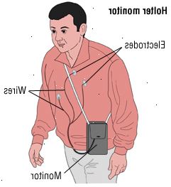 Fibrilace síní 3
