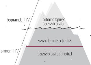 Celiac ledovce