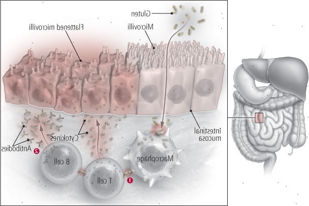Celiace proti srsti Celiace proti srsti