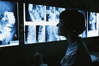 Obrázek lékaře prohlížení iriografie x-ray filmy Obrázek lékaře prohlížení iriografie x-ray filmy