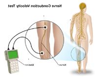 Ilustrace testu rychlosti nervových vedení